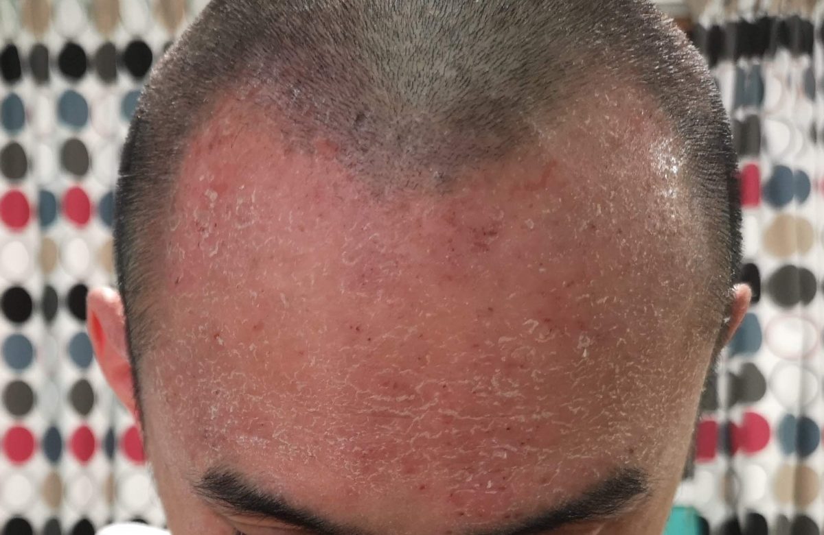 Day 10 I shaved my head and took a shower Healing TSW